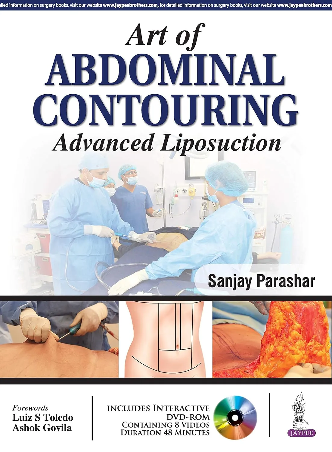 Book cover: Art of Abdominal Contouring by Dr. Sanjay Parashar