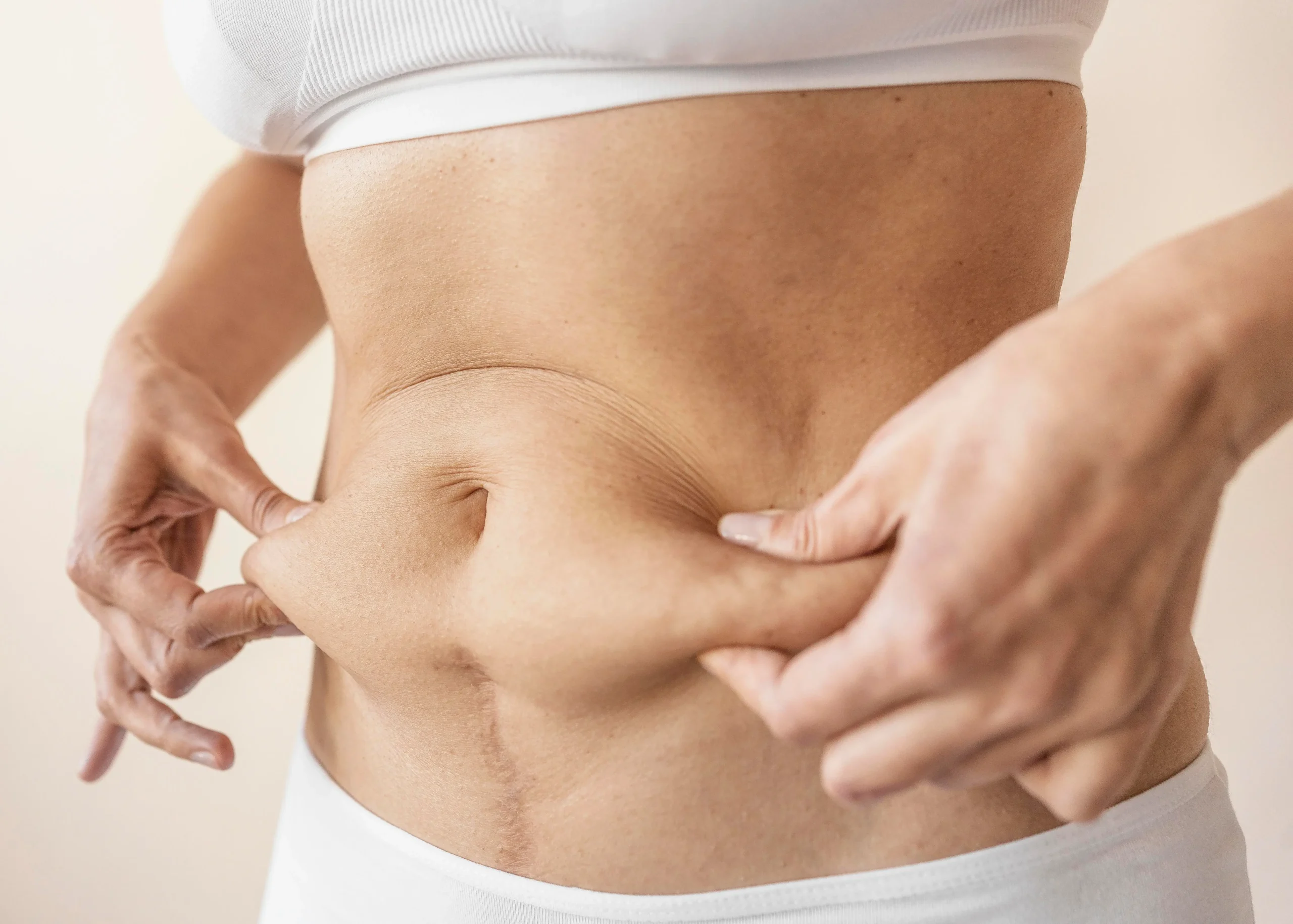 Patient consultation with Dr. Sanjay Parashar before tummy tuck in Dubai