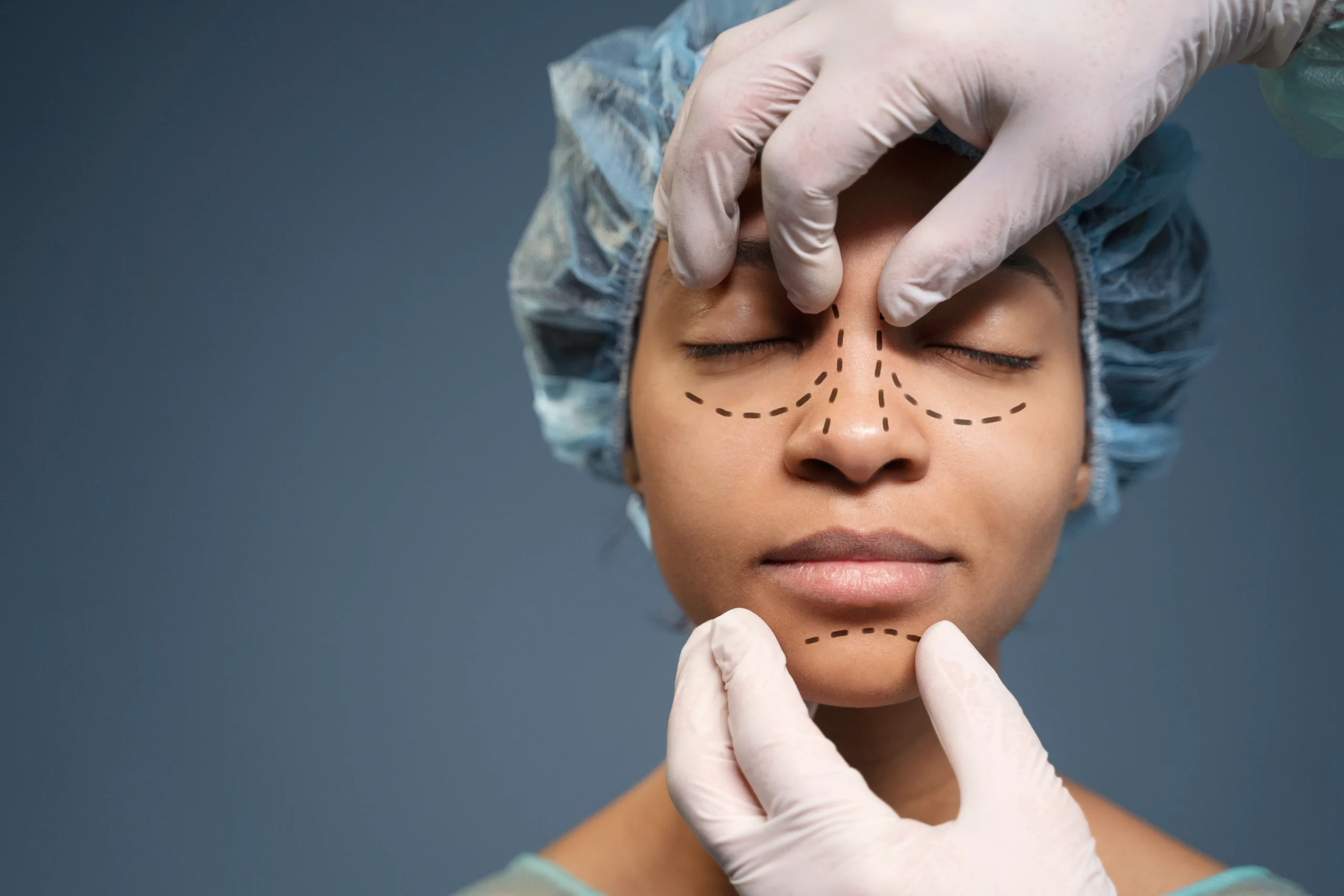 Woman checking her new nose profile after rhinoplasty in Dubai