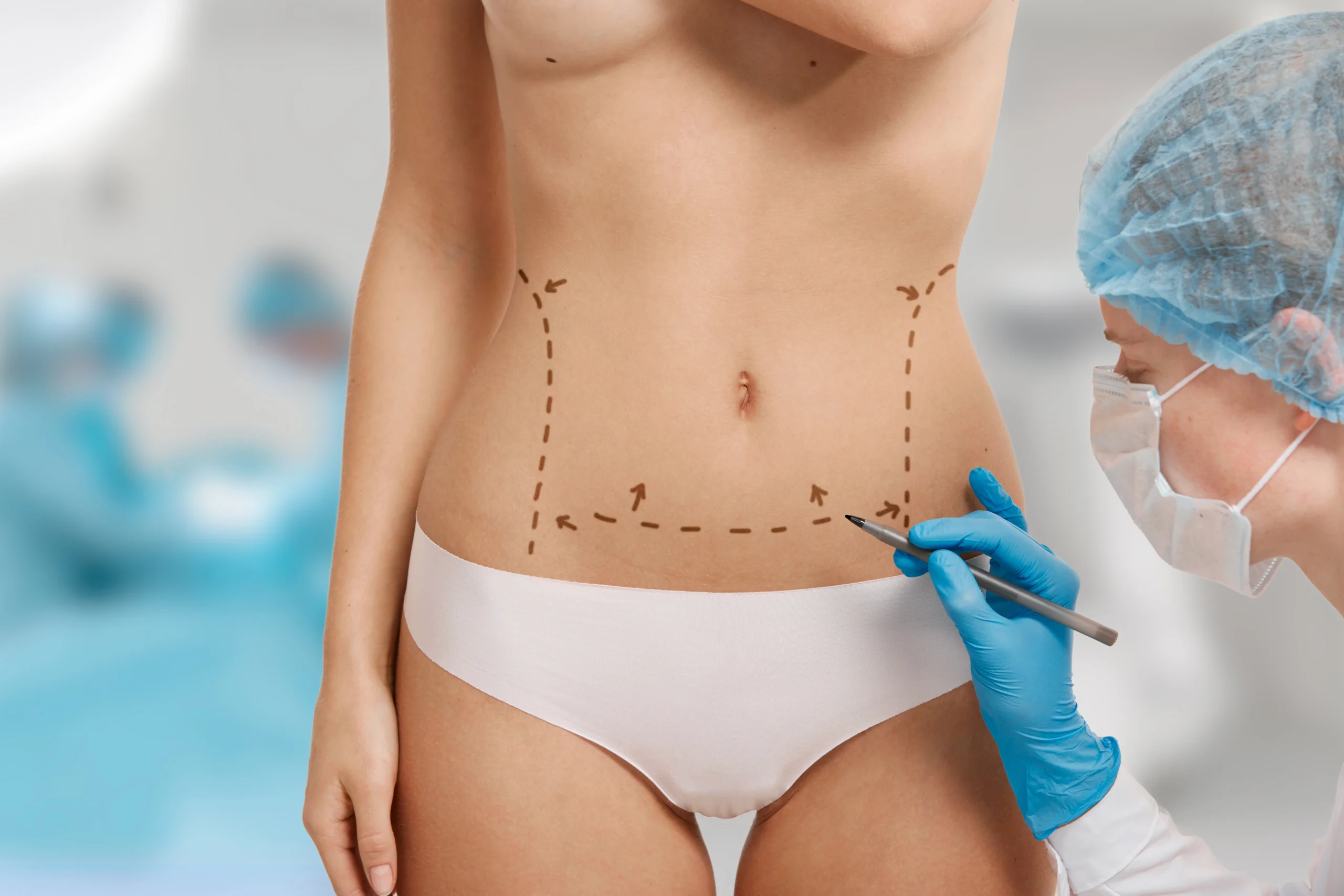 Liposuction In Dubai: Sculpt Your Dream Body With Dr. Sanjay Parashar