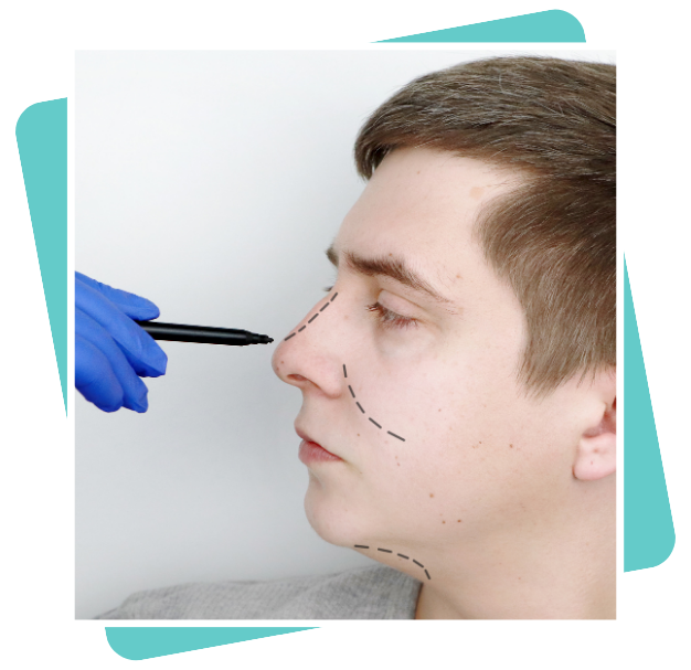 Best Septoplasty Surgeon In Dubai