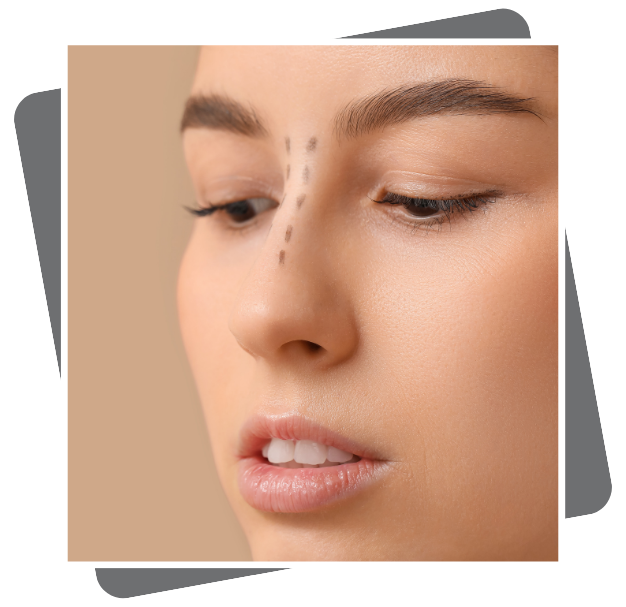 Best Septoplasty Clinic In Dubai