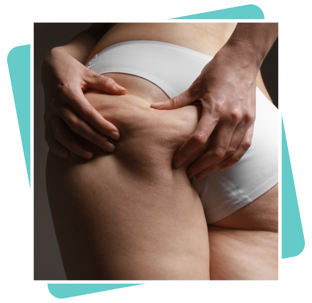 Best Buttocks Lift Surgeon In Dubai