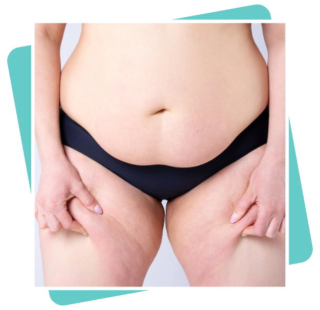 Best Liposuction Surgeon In Dubai