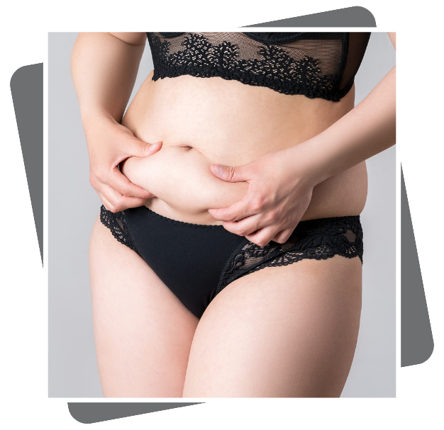 Best Mini Abdominoplasty Clinic In Dubai