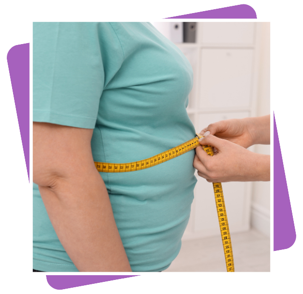 Best Waist Liposuction In Dubai