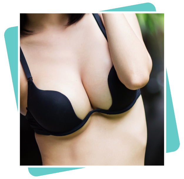 Best Breast Augmentation With Fat Transfer In Dubai