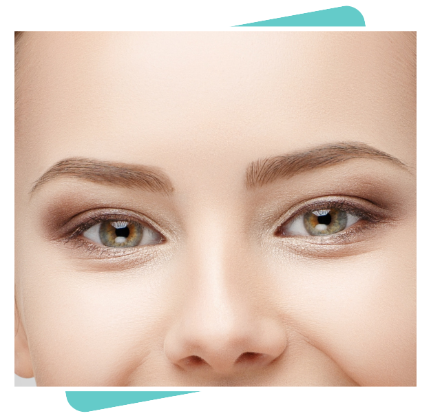 Best Blepharoplasty Surgeon In Dubai