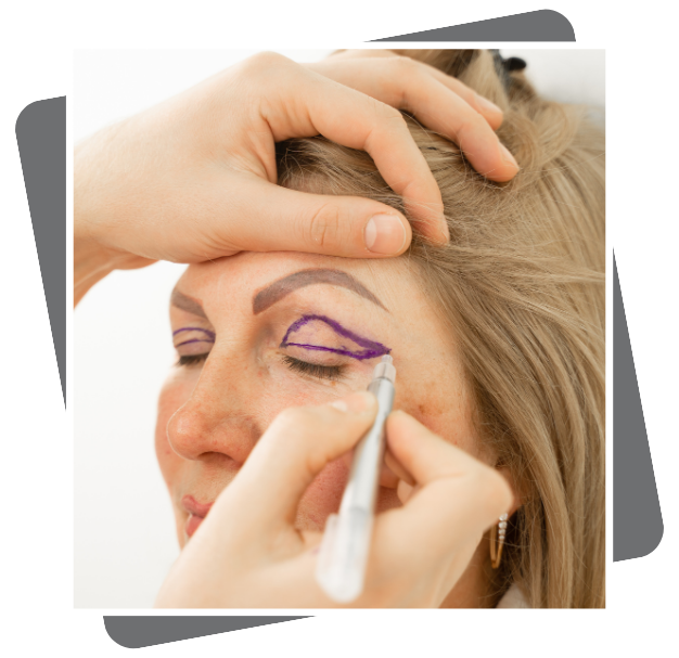 Blepharoplasty Surgeon In Dubai
