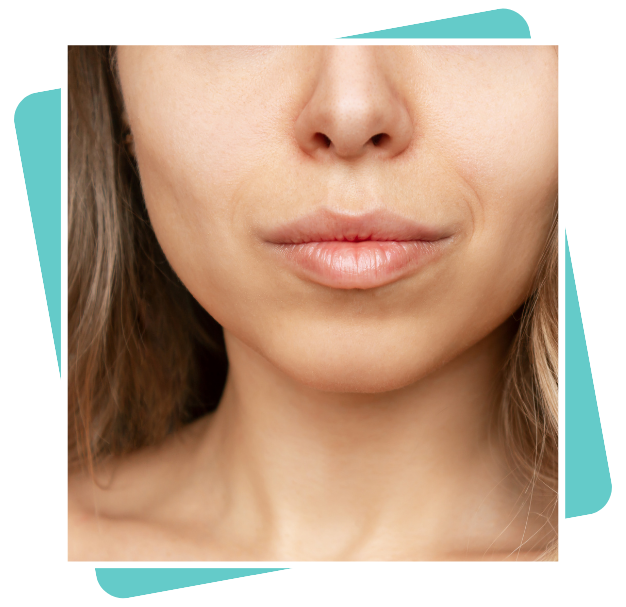 Best Buccal Fat Removal In Dubai