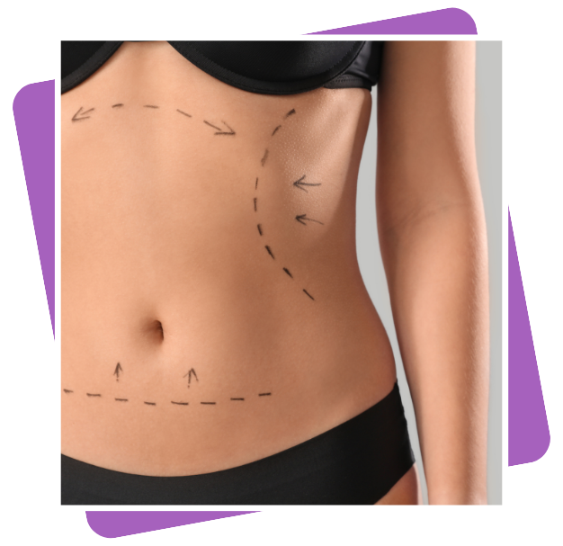 Best Ozempic Injection Clinic