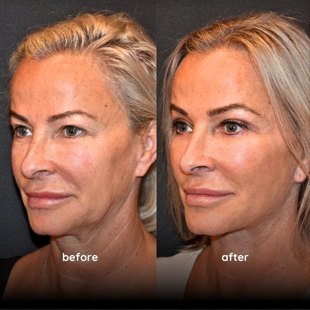 best facial plastic surgeon in Dubai