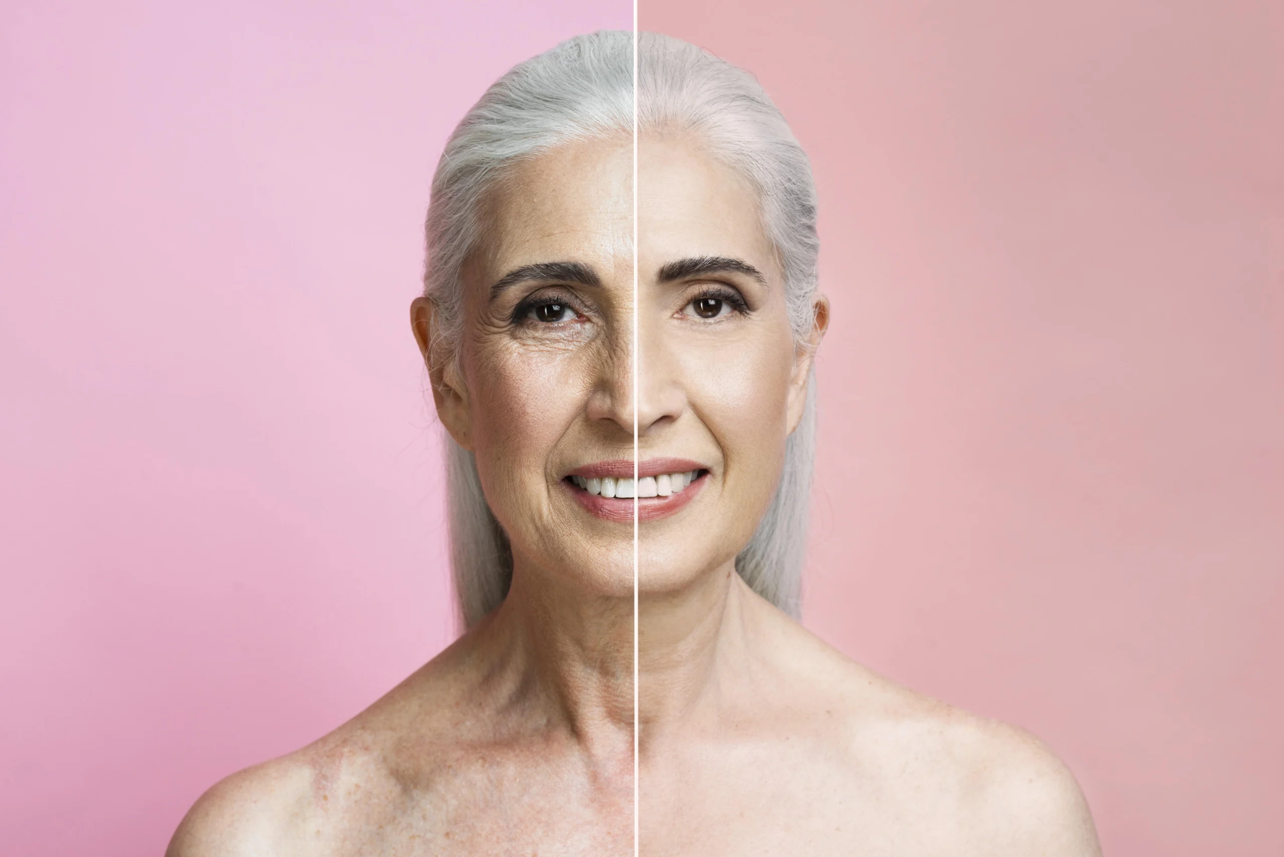 Woman showing youthful results after facelift surgery in Dubai
