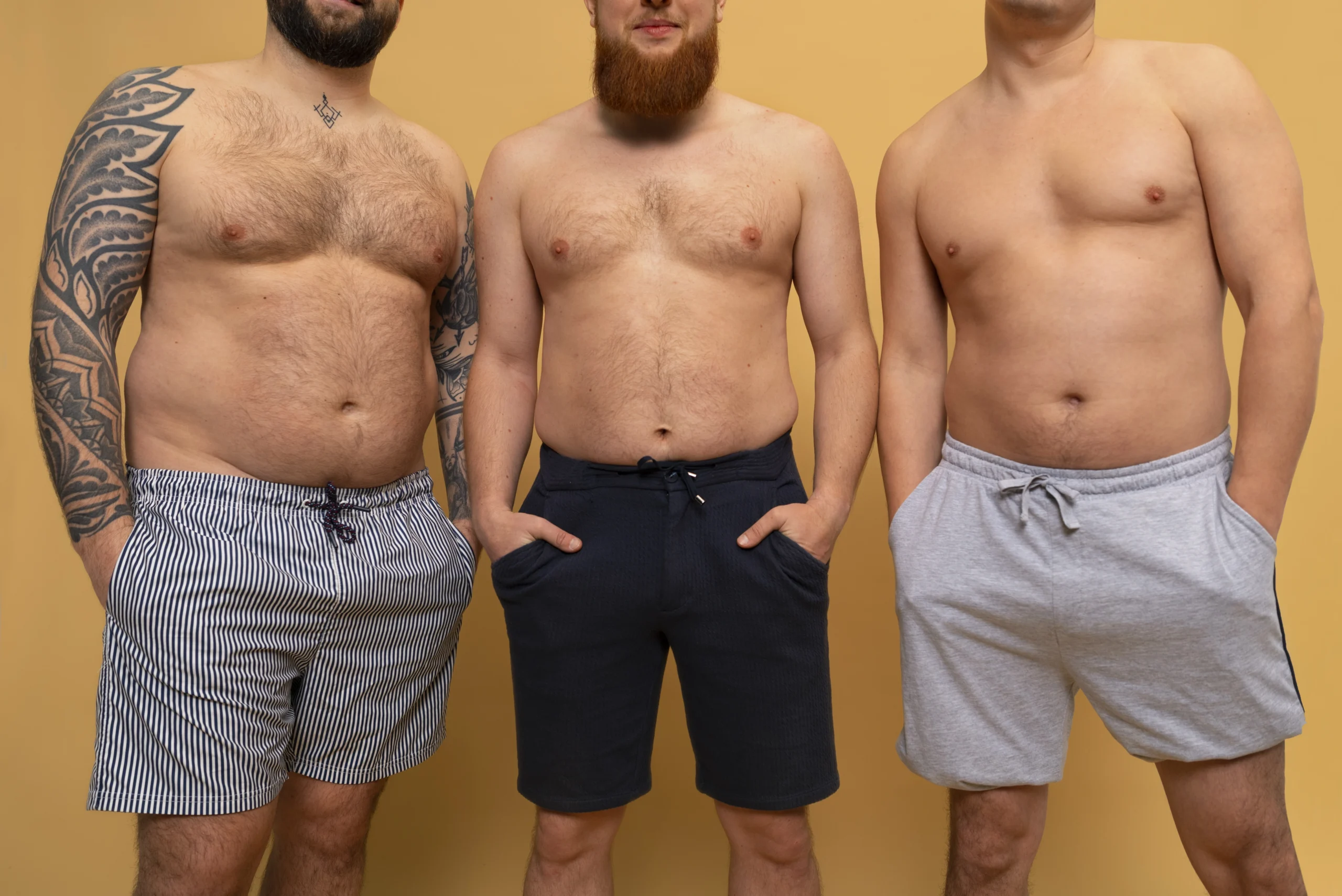 Post-recovery flat chest after gynecomastia surgery in Dubai