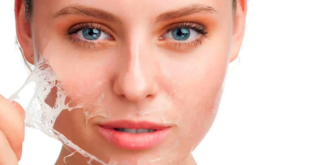 Chemical Peel in Dubai: Which Type Is Right for Your Skin