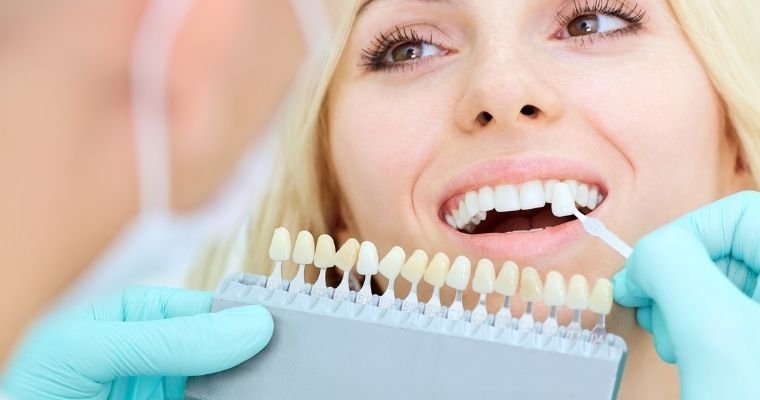 Teeth Whitening in Dubai: Professional vs At-Home Methods