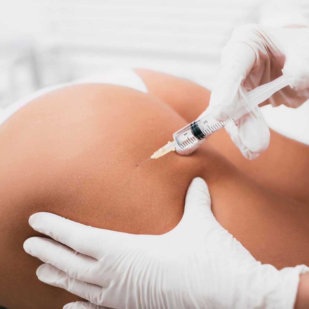 Buttock Lift in Dubai: Surgical Options for a Firmer and More Lifted Look