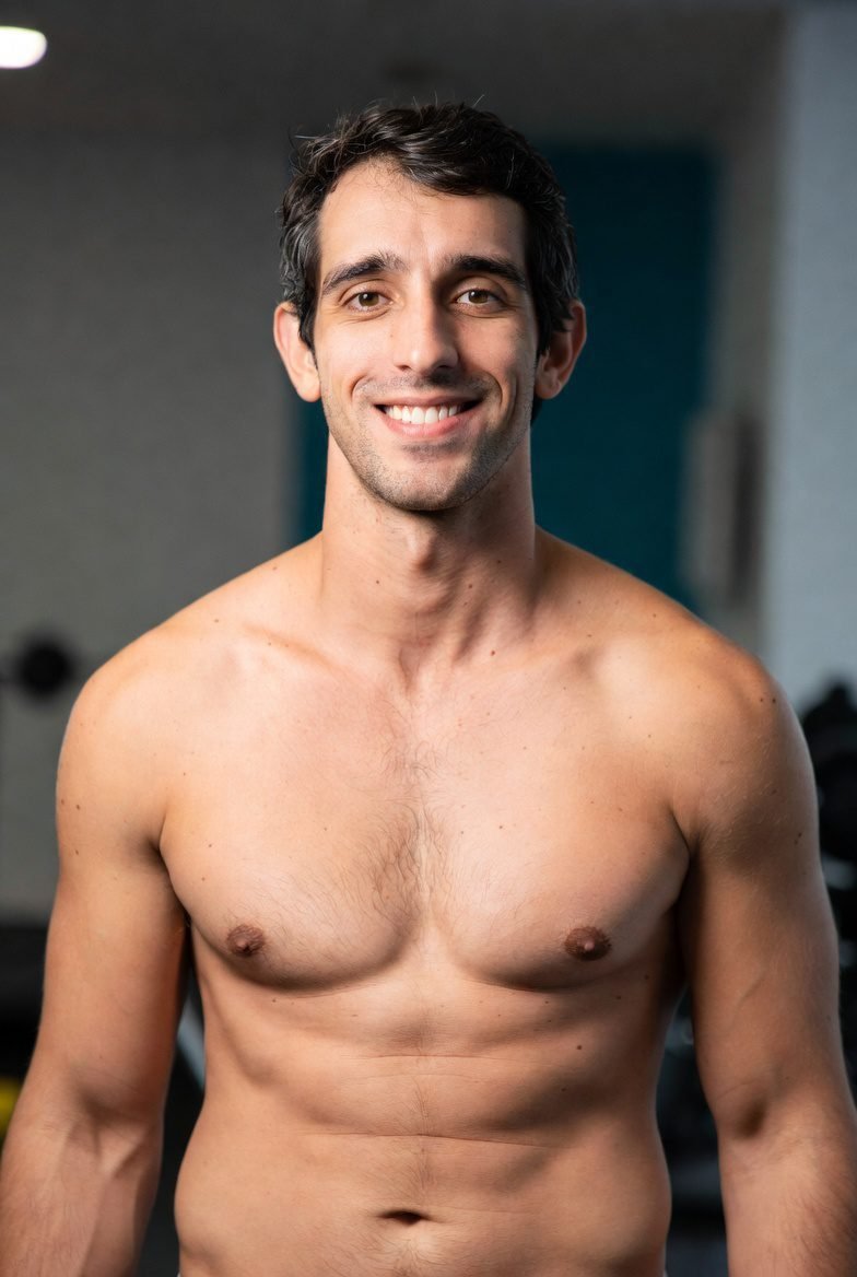 Gynecomastia In Dubai procedure image Dr. Sanjay Parashar Dubai image 2