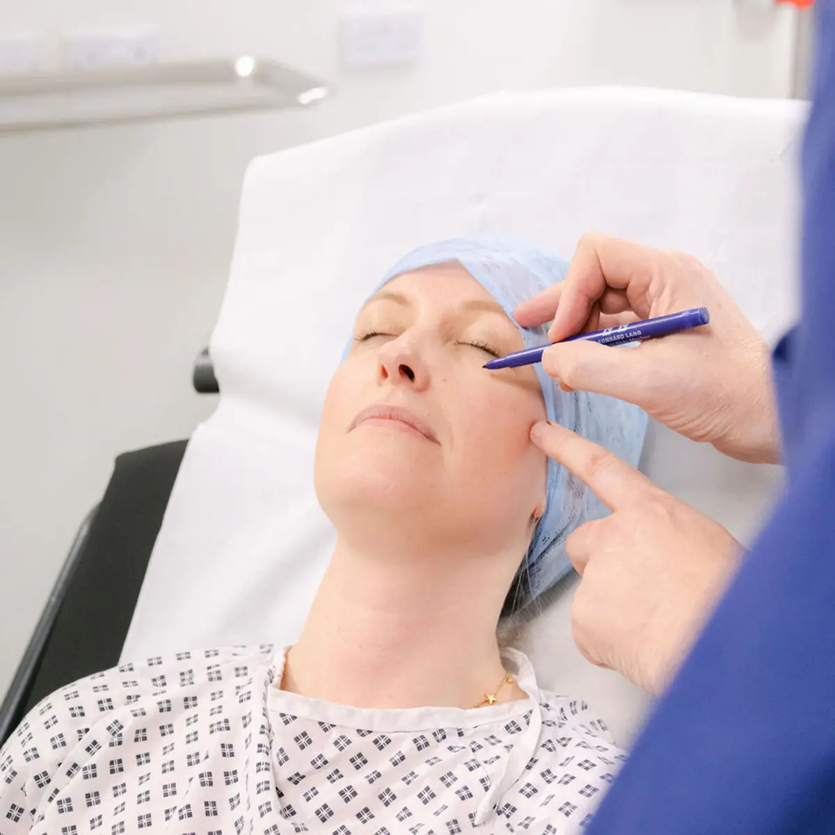 Blepharoplasty33