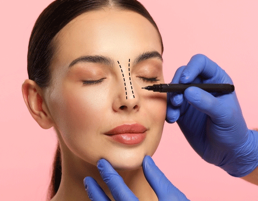 rhinoplasty33
