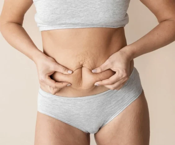 Tummy-Tuck223_1700736815_large