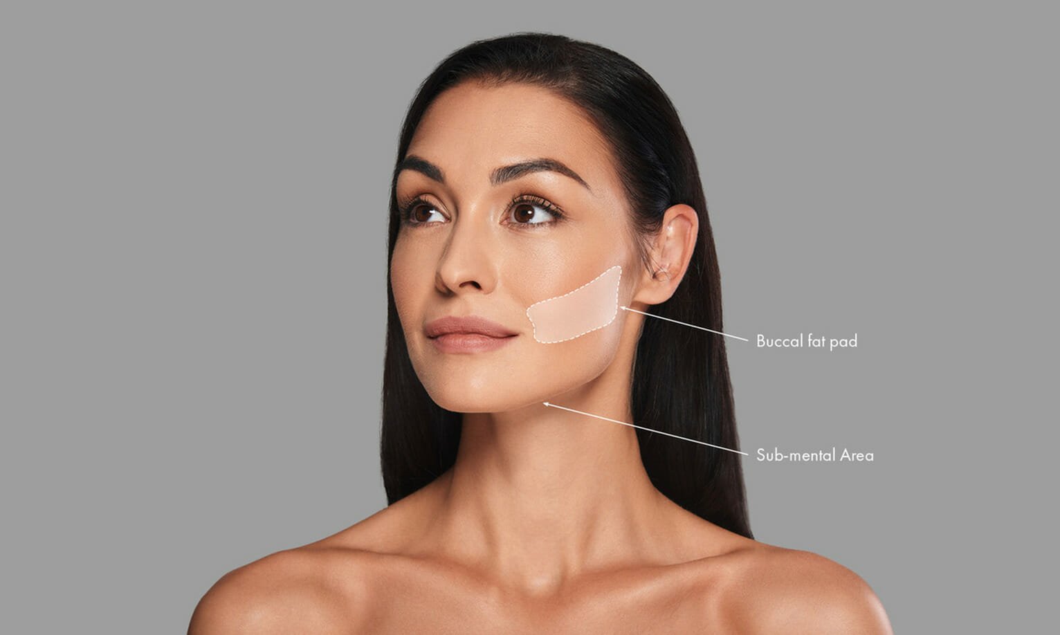Buccal-fat