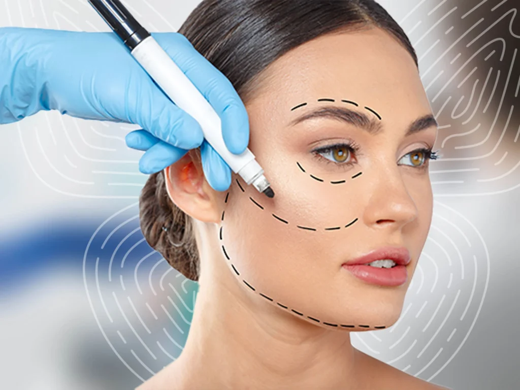 face-lift222