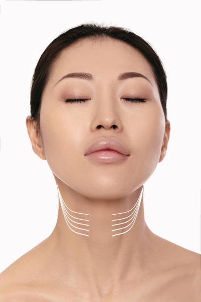 Istockphoto