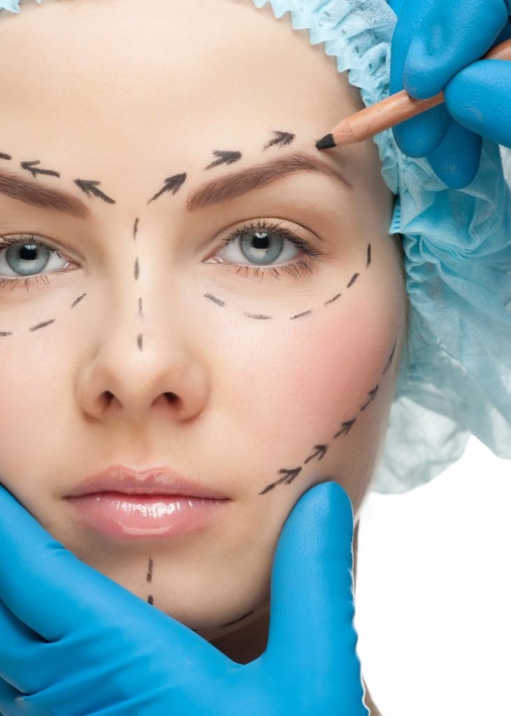 face-lift333