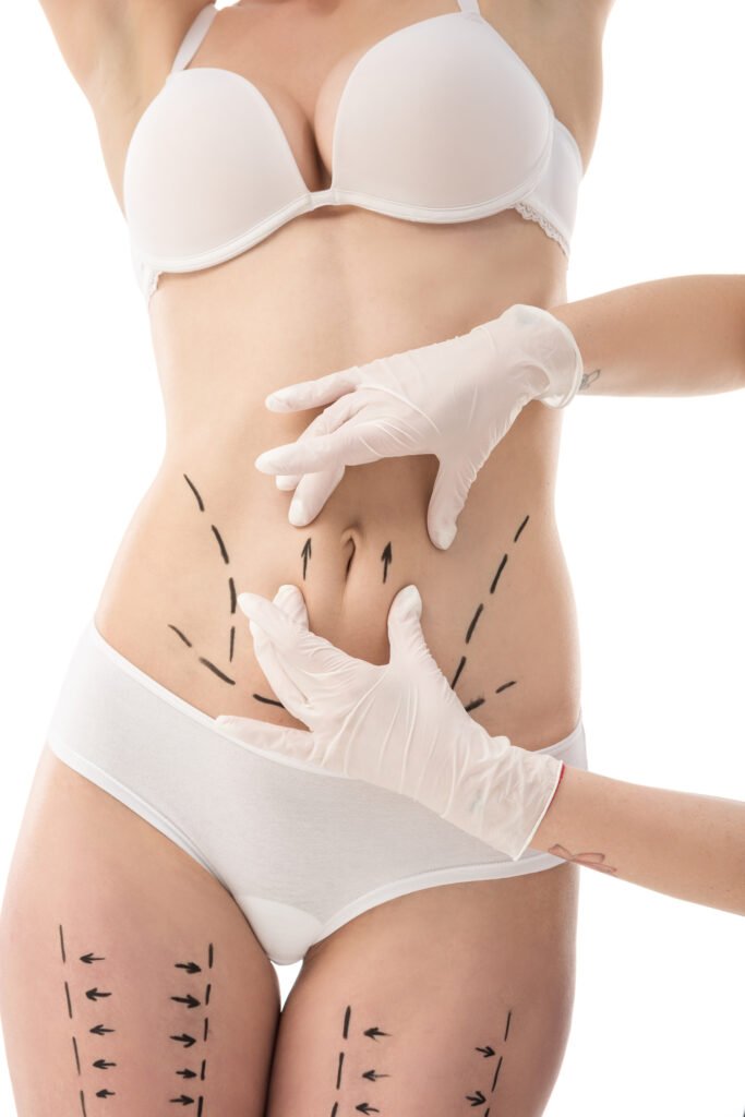 Liposuction690