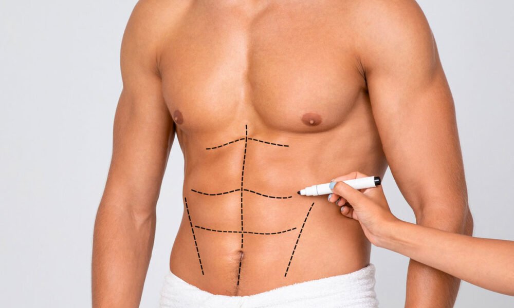 sixpack Liposuction333